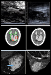 Medical Imaging